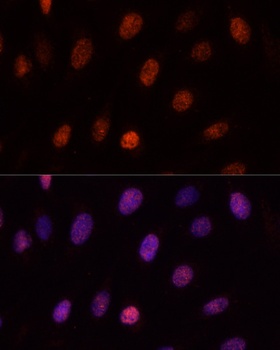 PCGF1 Antibody