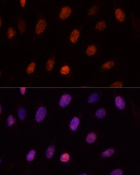 PCGF1 Antibody