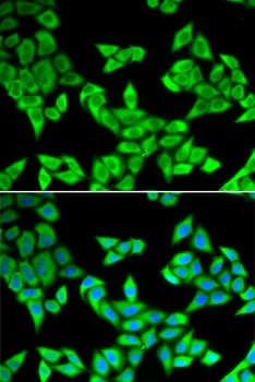 CIAPIN1 Antibody