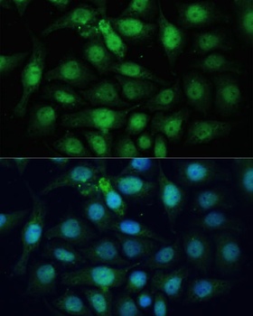 ZWINT Antibody