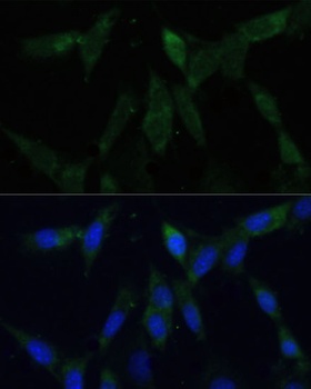 ZWINT Antibody