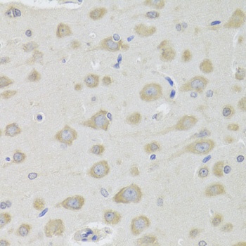 DHRS9 Antibody