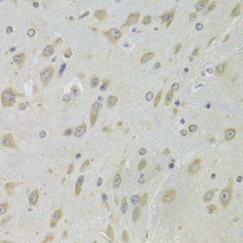 DHRS9 Antibody