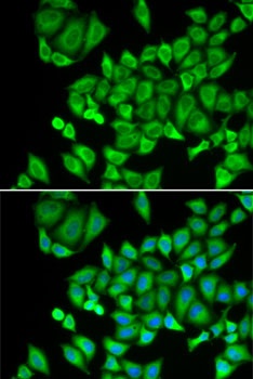 DHRS9 Antibody