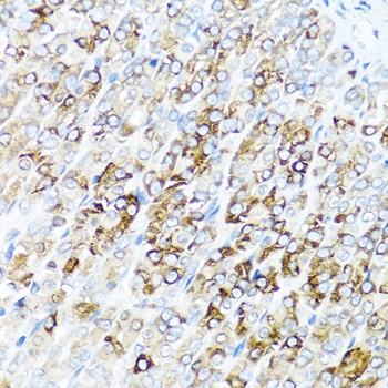 SERPINA7 Antibody