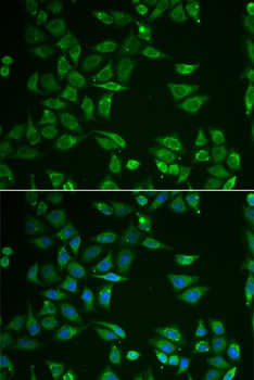 ST3GAL4 Antibody