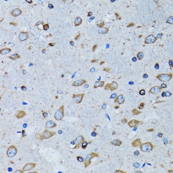 RARS Antibody