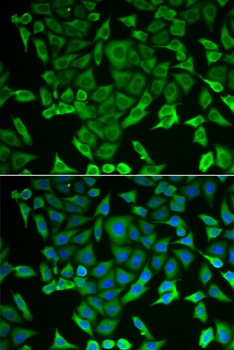 RARS Antibody