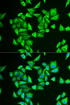 PGM1 Antibody