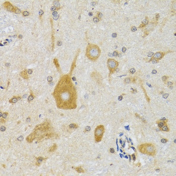 NEU1 Antibody