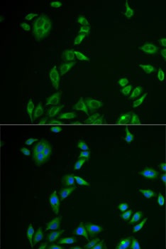 MLANA Antibody