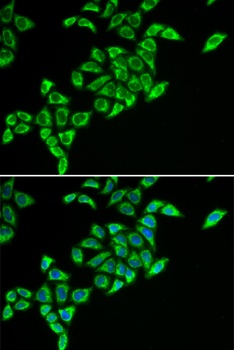 DLAT Antibody