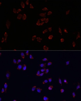 PLIN2 Antibody