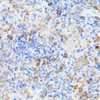 CHAF1B Antibody