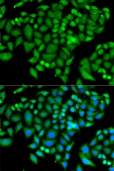 CHAF1B Antibody