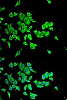 SERPINB1 Antibody