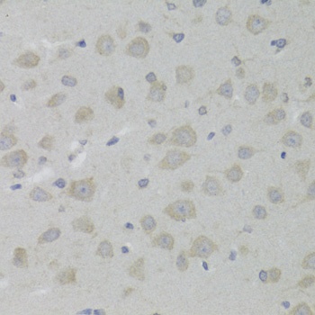 HSD17B13 Antibody