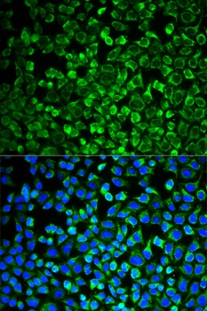 GAB1 Antibody