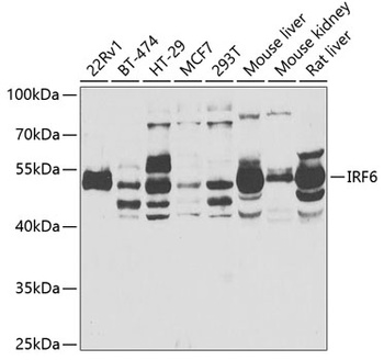 IRF6 Antibody
