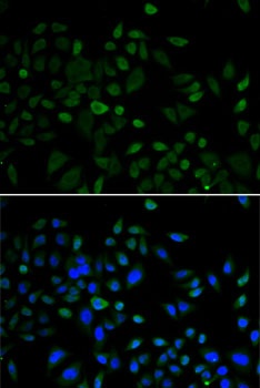 CBX8 Antibody