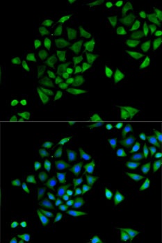 CYP2C9 Antibody