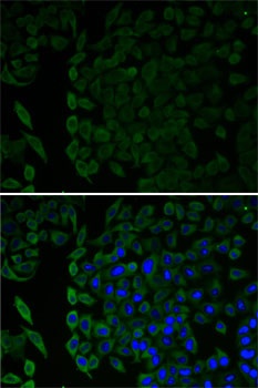 MSLN Antibody