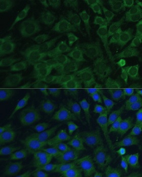 OSM Antibody