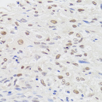 HMGN1 Antibody