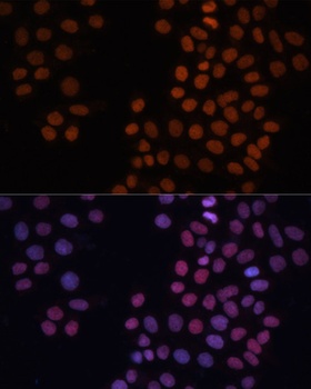 HMGN1 Antibody