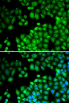 KMT2E Antibody