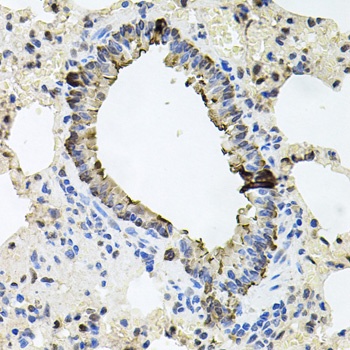 ERBB4 Antibody