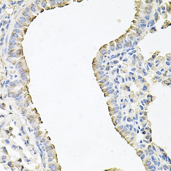 SCNN1G Antibody