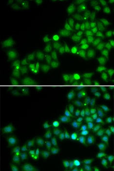 POLK Antibody