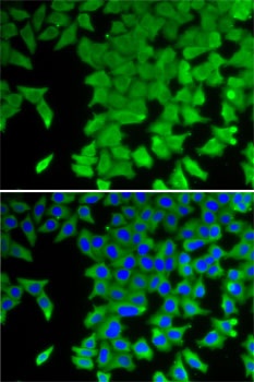 CRABP2 Antibody