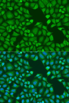 TNRC6A Antibody