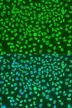 KHDRBS1 Antibody