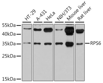 RPS6 Antibody