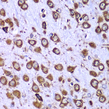 RPS10 Antibody