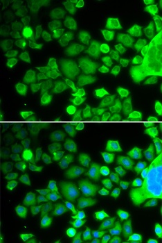 RPS10 Antibody