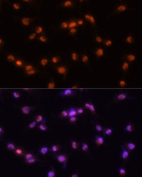 PRPF8 Antibody