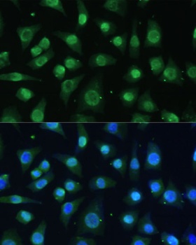 HNRNPA0 Antibody