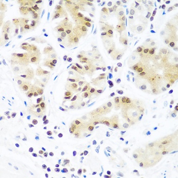 EIF2C2 Antibody