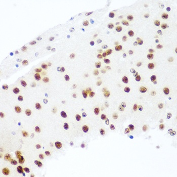 EIF2C2 Antibody