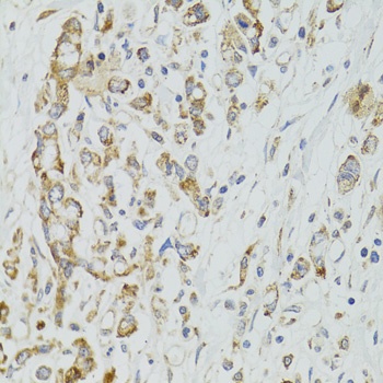 DICER1 Antibody