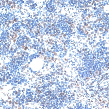 AQR Antibody