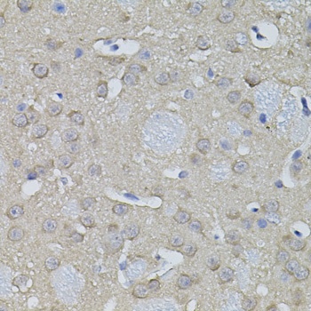 ACO1 Antibody