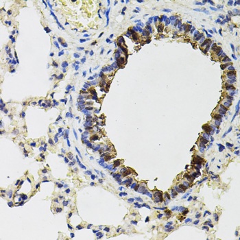 ACO1 Antibody