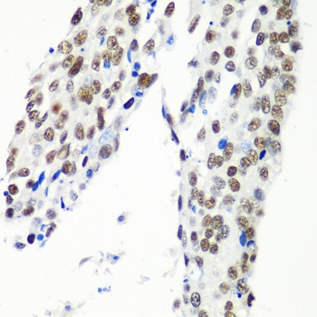 HTATSF1 Antibody