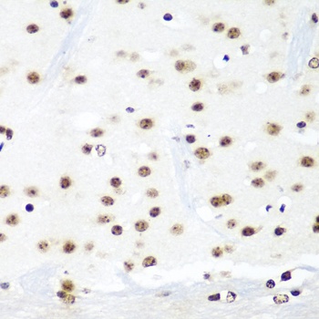 HTATSF1 Antibody