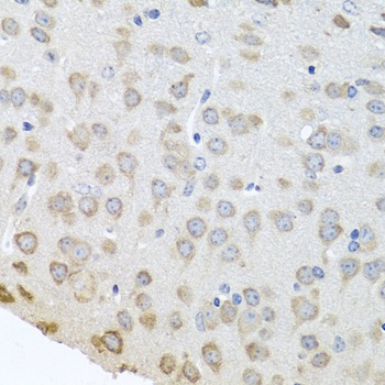 PABPC4 Antibody